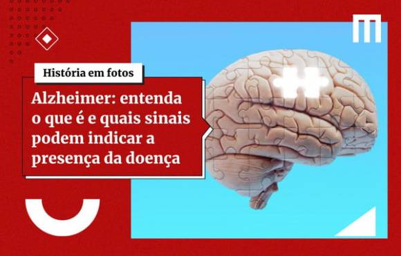Molécula descoberta por brasileiros tem potencial contra Alzheimer